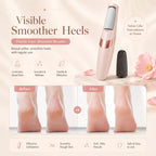 Viter® Electric Callus Remover